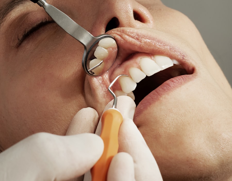 Cleanings & Oral Exams
